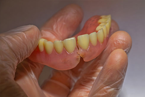 denture-repairs Denture Repairs