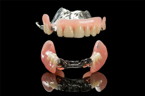 partial-dentures Partial Dentures